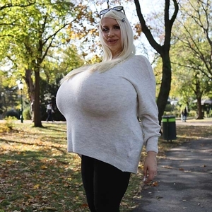 Walking around with the largest augmented breast in public